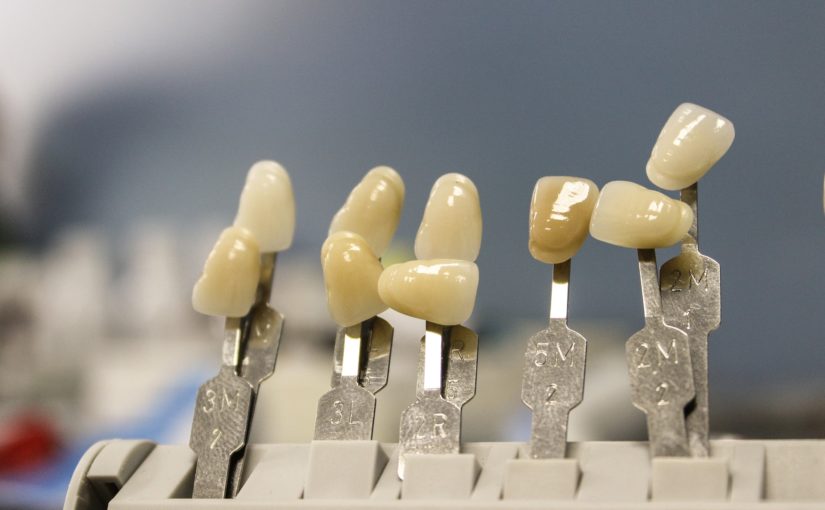 Ładne urodziwe zęby oraz powalający cudny uśmiech to powód do dumy.